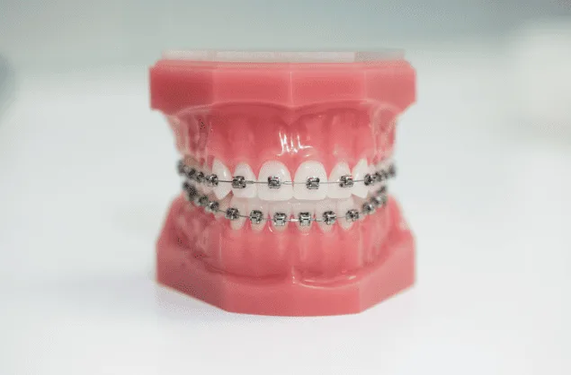 Braces Orthodontics 箍牙 牙齒矯正