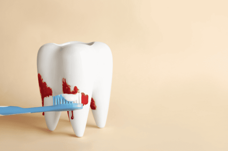 Gum Disease Causes Symptoms Treatment 牙周病成因 症狀 治療