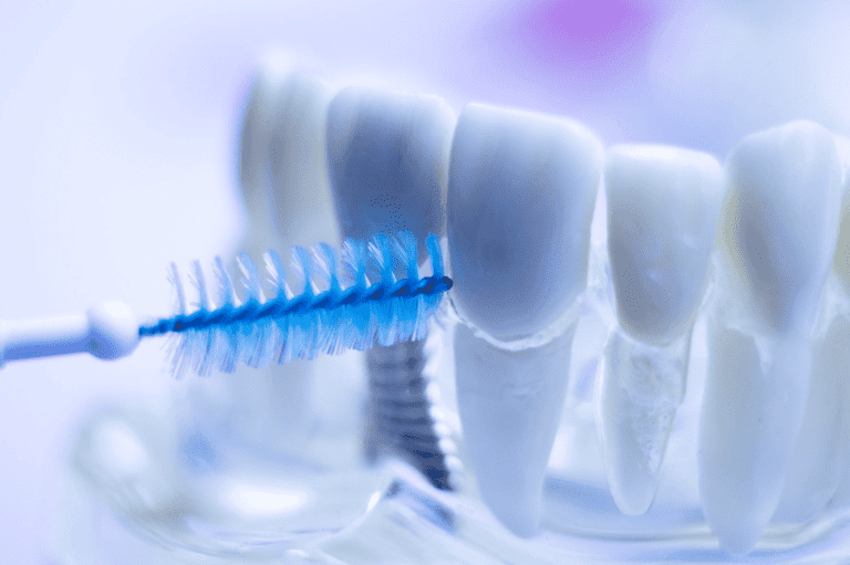 【Interdental Brush Guide】How to Choose and Use It? Who Should Use It