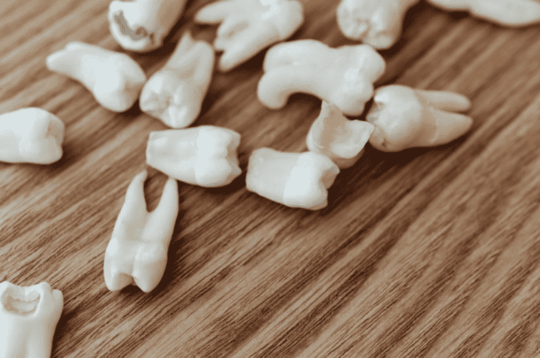Tooth Decay Symptoms, Prevention, Treatment 蛀牙症狀,預防,治療