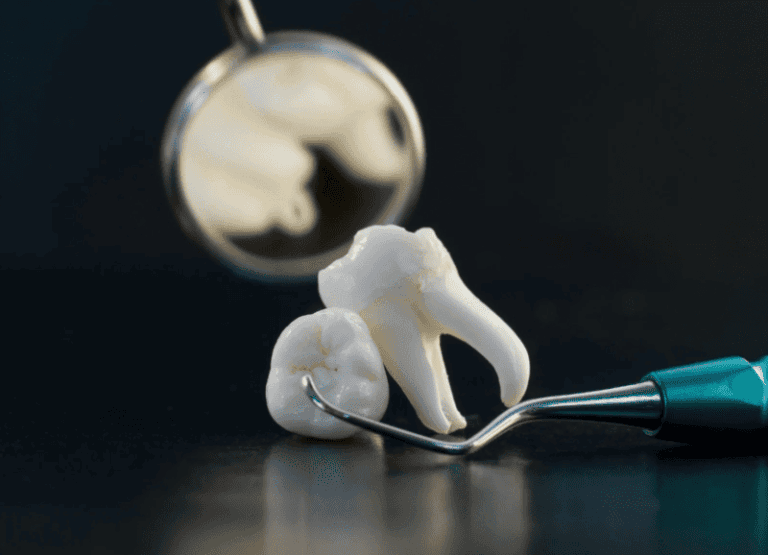 Wisdom Teeth Impaction and Inflammation 智慧齒橫生與發炎