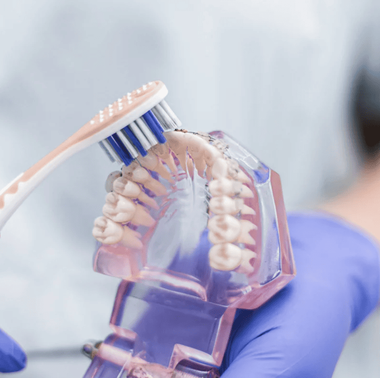 choose the right teeth whitening method 選擇合適的牙齒美白方法