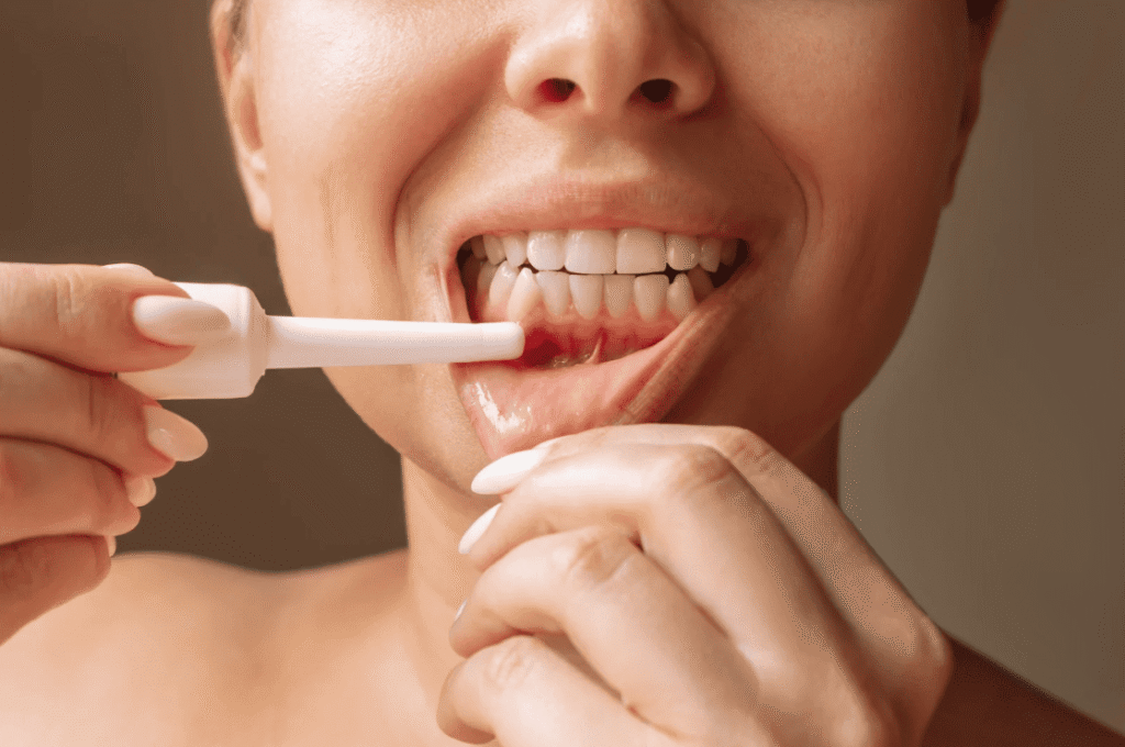 treatment for mouth ulcers 口腔潰瘍快速治療方法