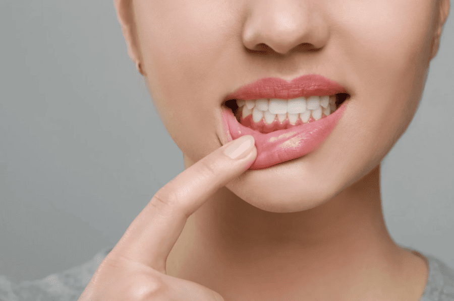 Gum Disease Treatment (Periodontal Disease) 牙周病治療