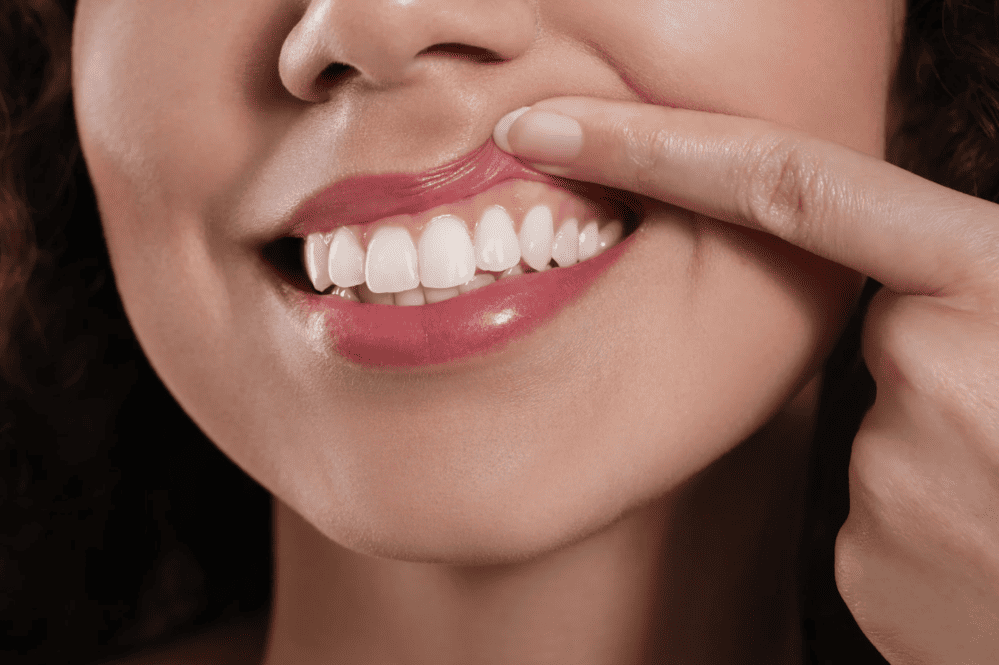 牙肉萎縮治療 gum recession treatment