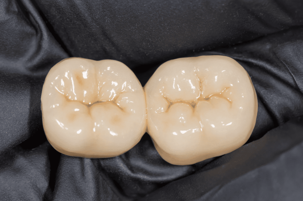 Risks of Bruxism 磨牙的風險