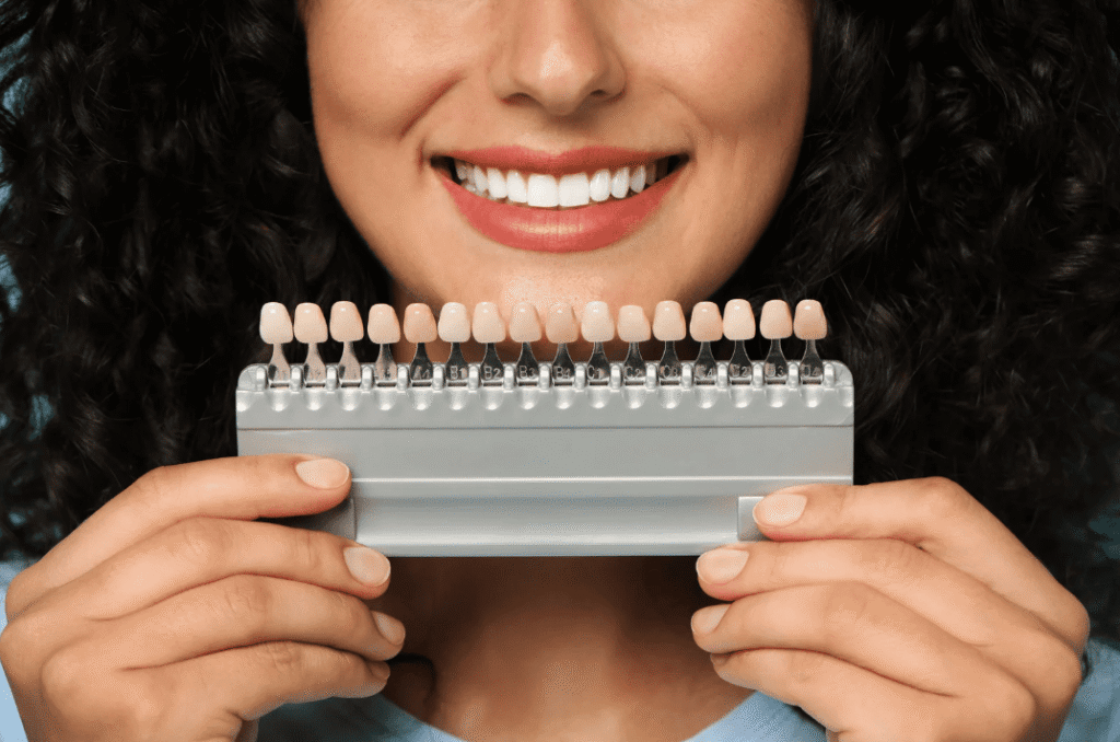 Veneer Treatment Cost 牙齒貼片療程價錢